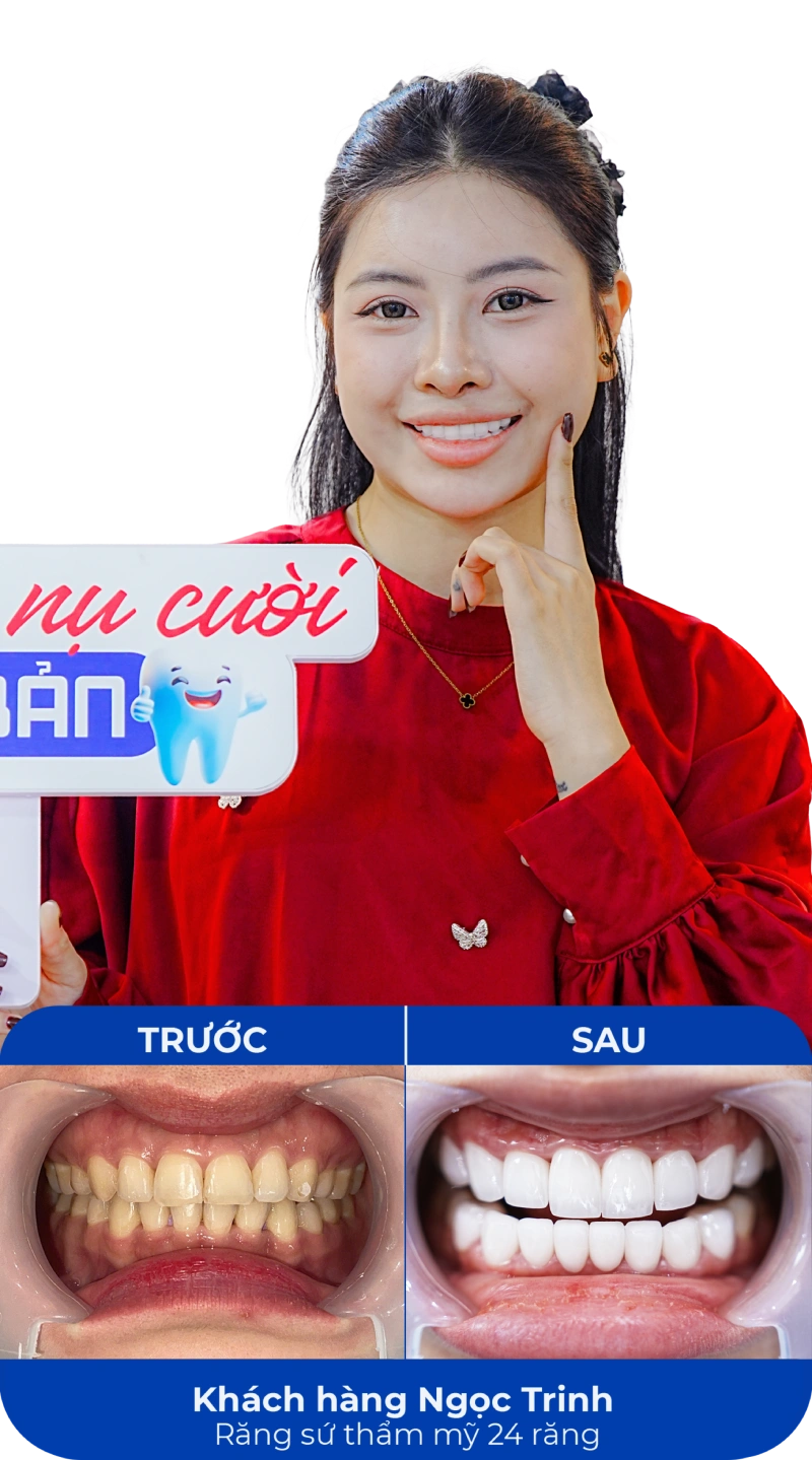 Ảnh trước và sau khi làm răng tại SC Dental