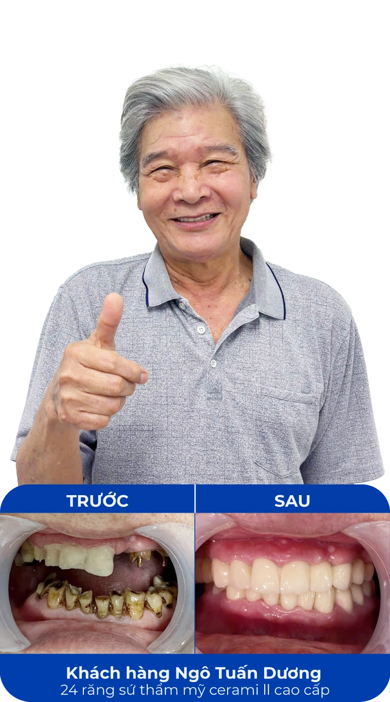 Ảnh trước và sau khi làm răng tại SC Dental